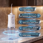 Cordless Water Flosser-Blast Out What Your Toothbrush Leaves Behind